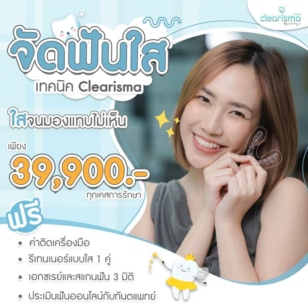 รีวิวจัดฟันแบบใส ใสจนมองแทบไม่เห็น