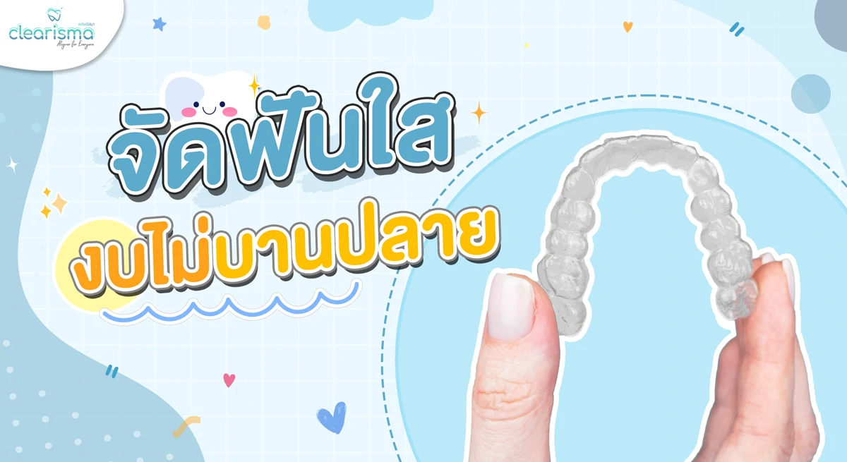 จัดฟันใสที่ไหนดีราคาไม่แพง