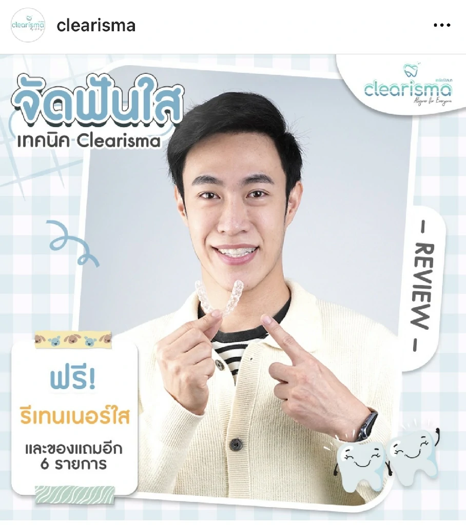 รีวิวจัดฟันแบบใส-สมัครเคสรีวิว