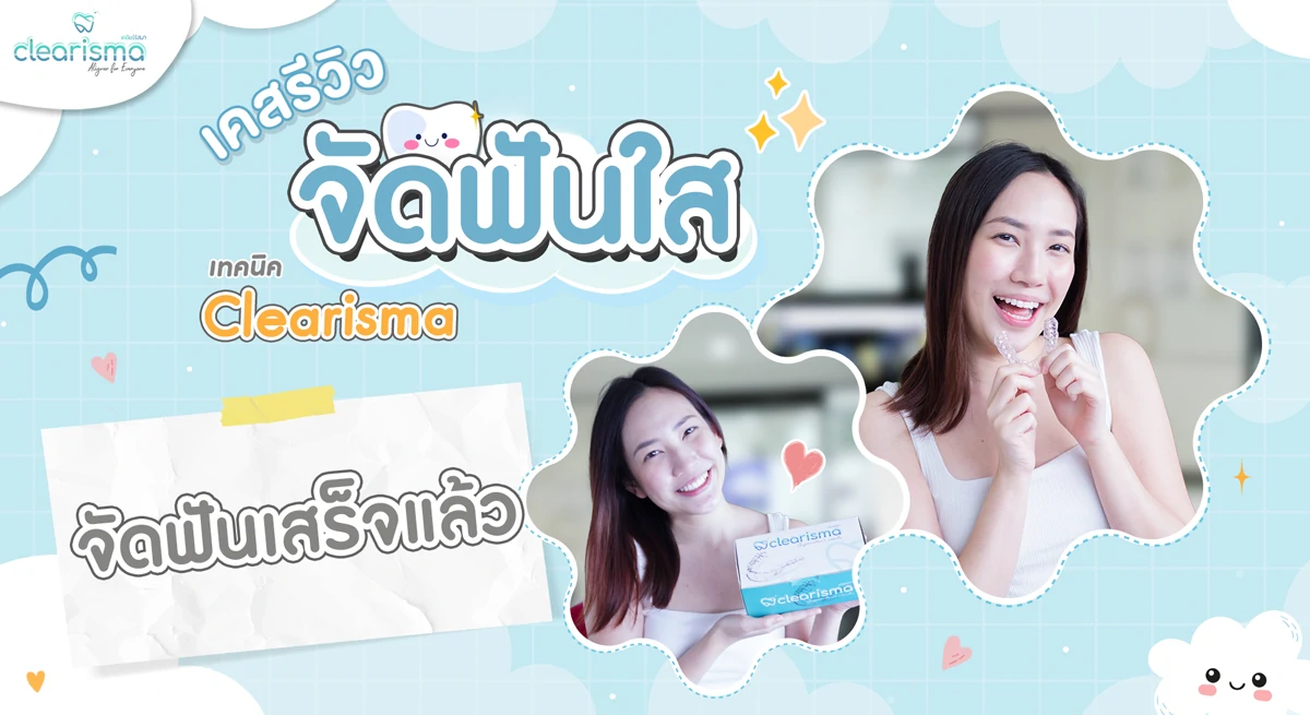 รีวิวจัดฟันแบบใสคุณการ์ตูน