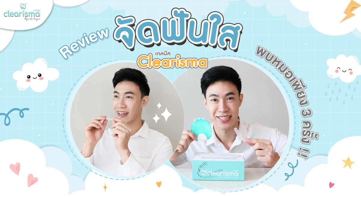 รีวิวจัดฟันแบบใสคุณผิงอัน