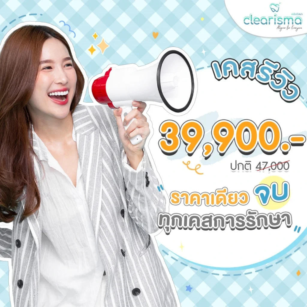 รีวิวจัดฟันแบบใส-ราคาเดียวทุกเคส