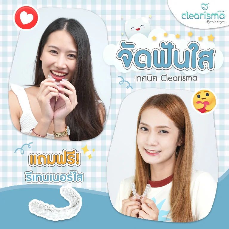 เคสรีวิวจัดฟันใส 4