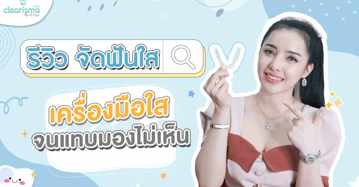 [รีวิวจัดฟันแบบใส] จัดฟันรอบที่สองด้วยแผนการรักษาเพียงแค่ 6 เดือนเท่านั้น!! สุดปัง!!