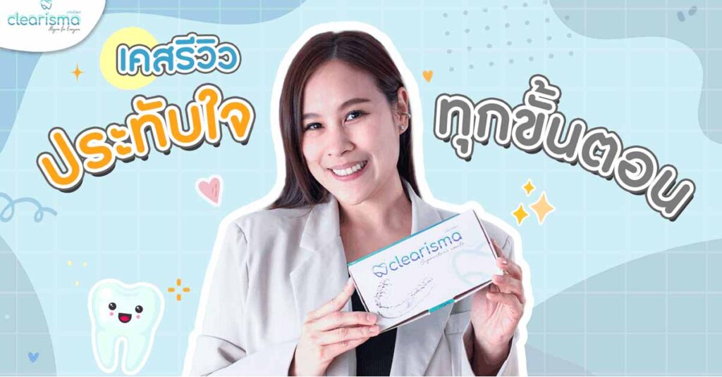 real-case-your-aligner-nemo-smile