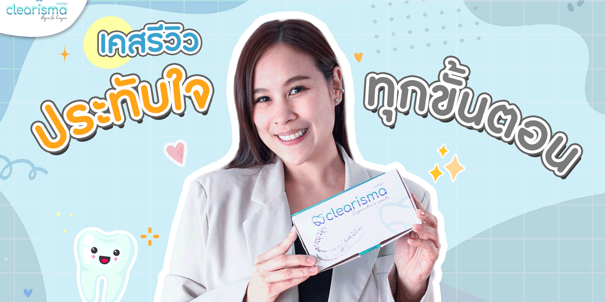 รีวิวจัดฟันใส-อัณณพัสส์