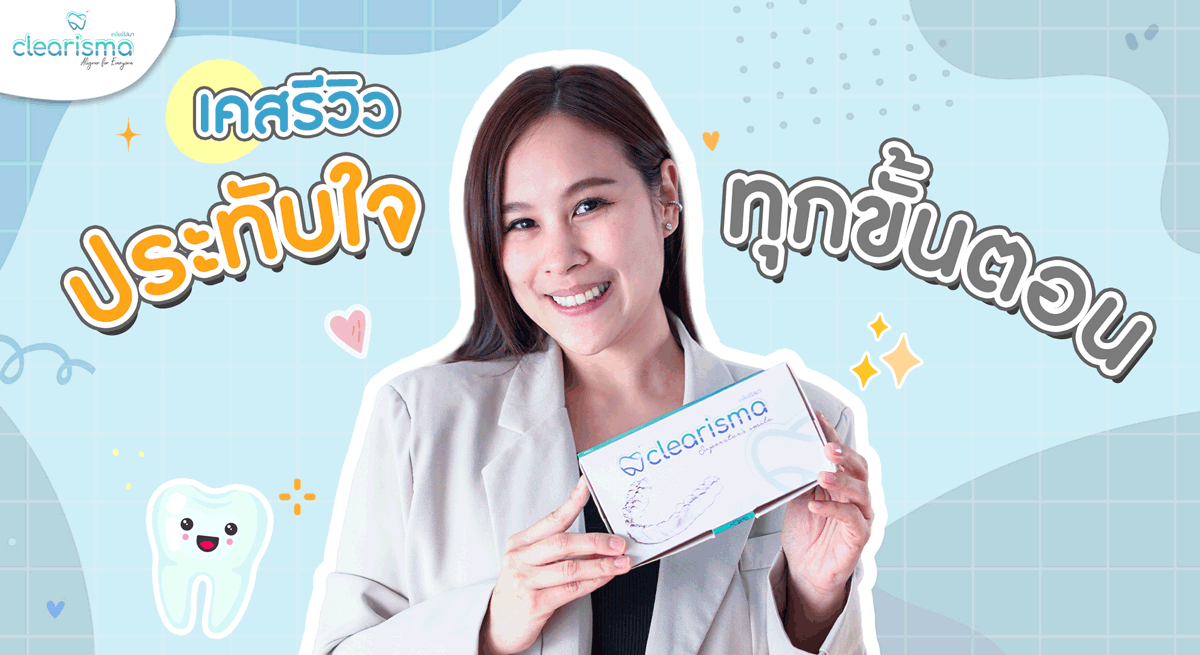 รีวิวจัดฟันใส-อัณณพัสส์