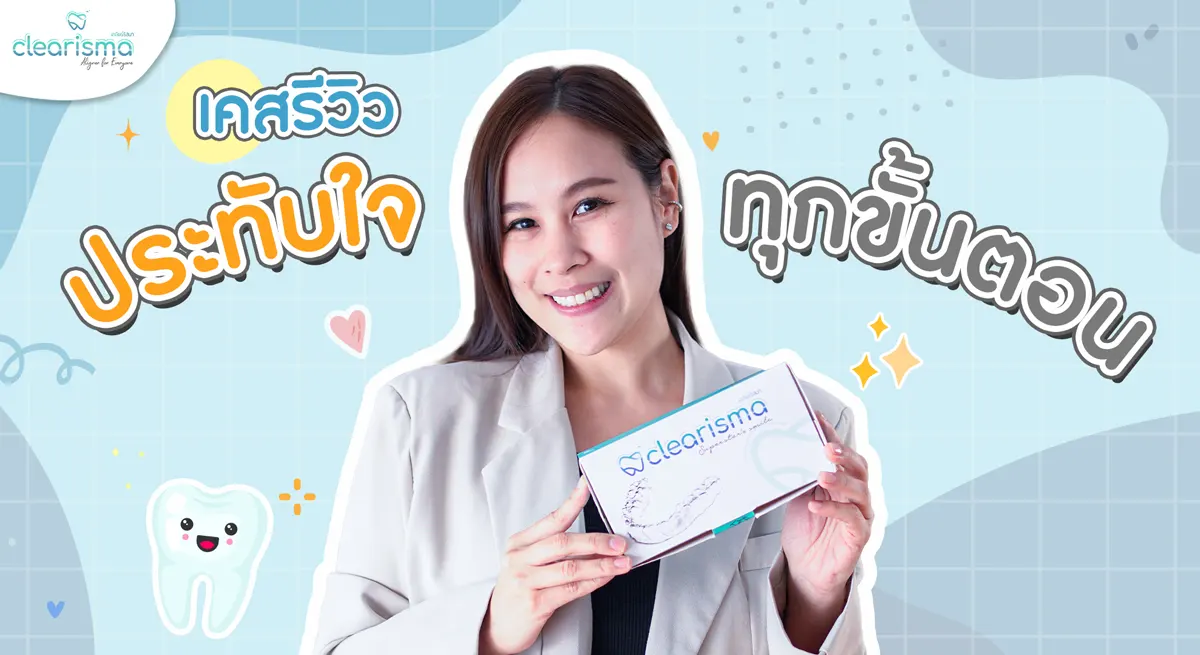 รีวิวจัดฟันใส-อัณณพัสส์