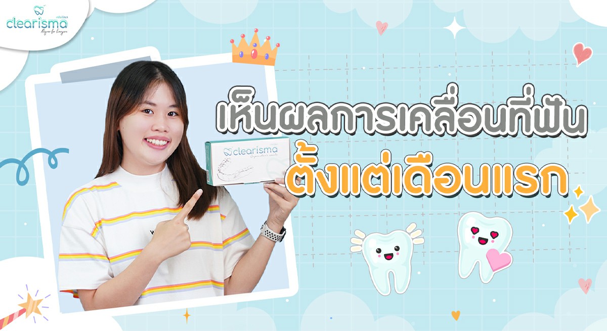รีวิวจัดฟันใสคุณ ชนิกานต์