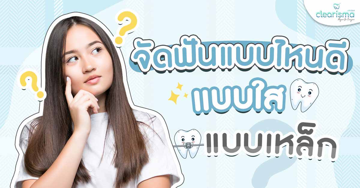 ตัดสินใจเลือกจัดฟันแบบไหนดีนะ! แล้วจัดฟันแต่ละแบบต่างกันอย่างไร ?