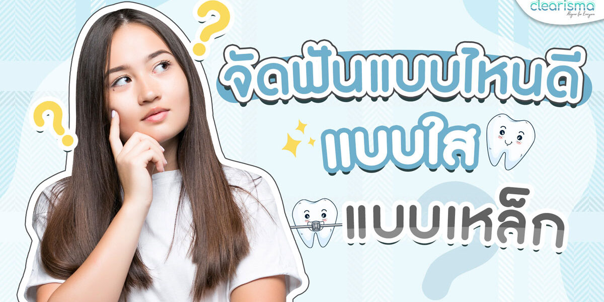 จัดฟันแบบไหนดี