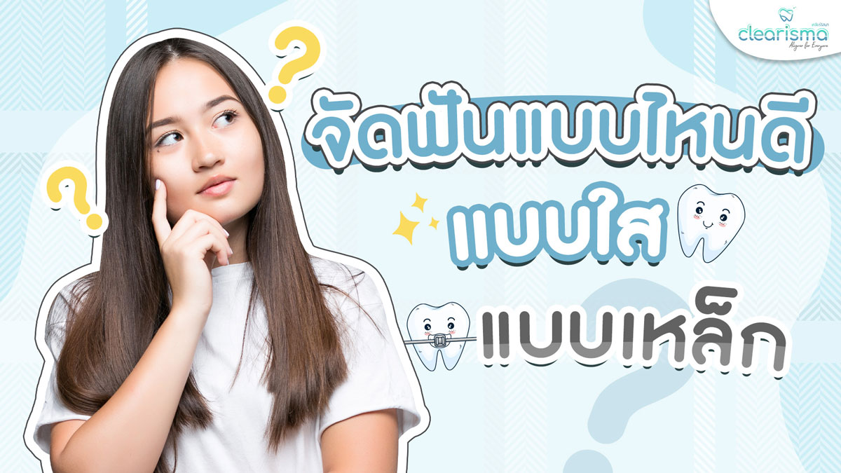 จัดฟันแบบไหนดี