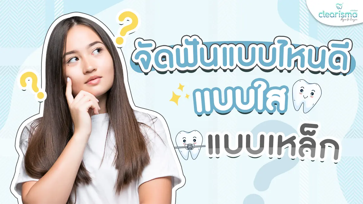 จัดฟันแบบไหนดี