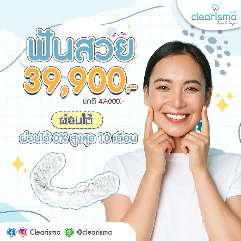 จัดฟันสวยผ่อนได้