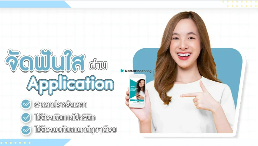 รีวิวจัดฟันแบบใส-Application