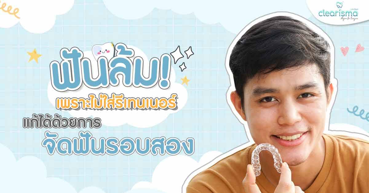 จัดฟันเสร็จแล้วไม่ใส่รีเทนเนอร์ ทำให้ฟันล้ม เป็นสาเหตุให้ต้องมาจัดฟันรอบสอง