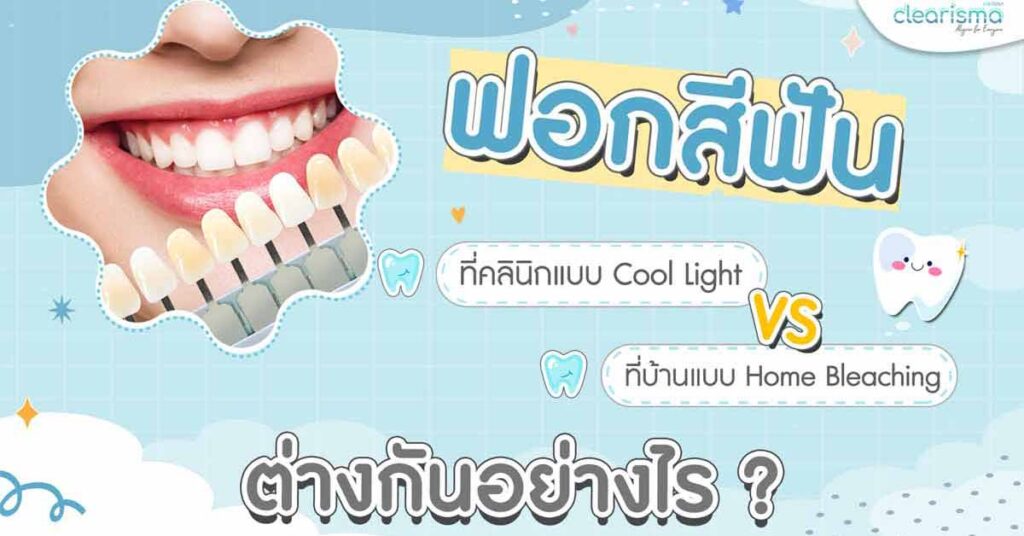 coollight-home-bleaching-teeth-whitening