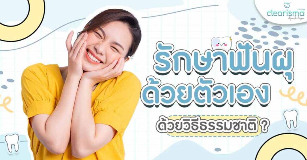 tooth-decay-fill-teeth-dental