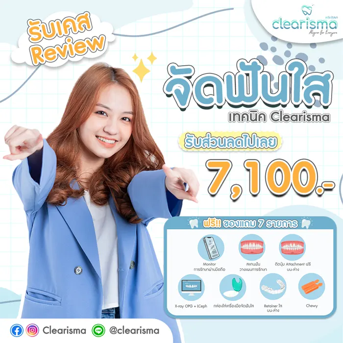 จัดฟันรอบสอง-ของแถม