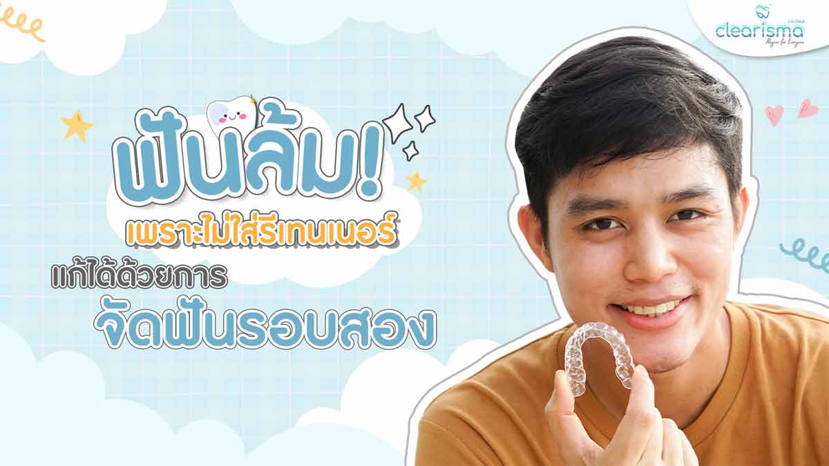 จัดฟันรอบสอง-ไม่ใส่รีเทนเนอร์