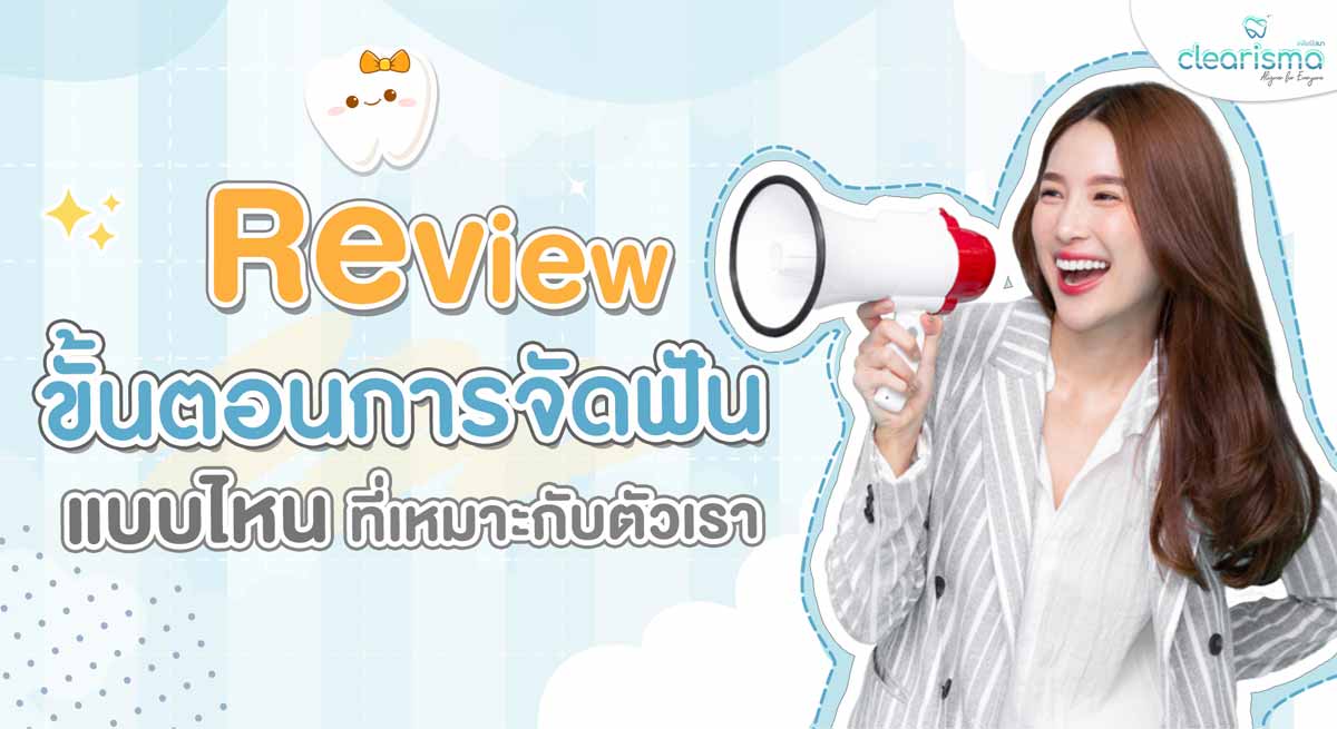 การจัดฟันมีกี่แบบ แล้วขั้นตอนการจัดฟันแบบไหนที่เหมาะกับตัวเรา