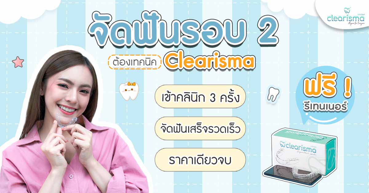 จัดฟันรอบ 2 ต้องเทคนิค Clearisma