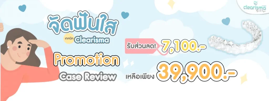 จัดฟันใสราคาถูก