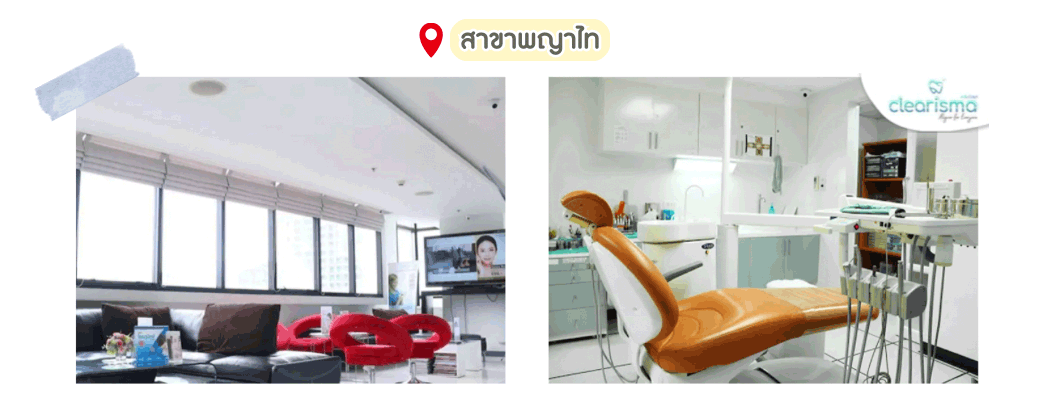 จัดฟันใสสาขาพญาไท