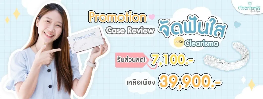 จัดฟันรอบ 2 โปรโมชัน เคสรีวิว