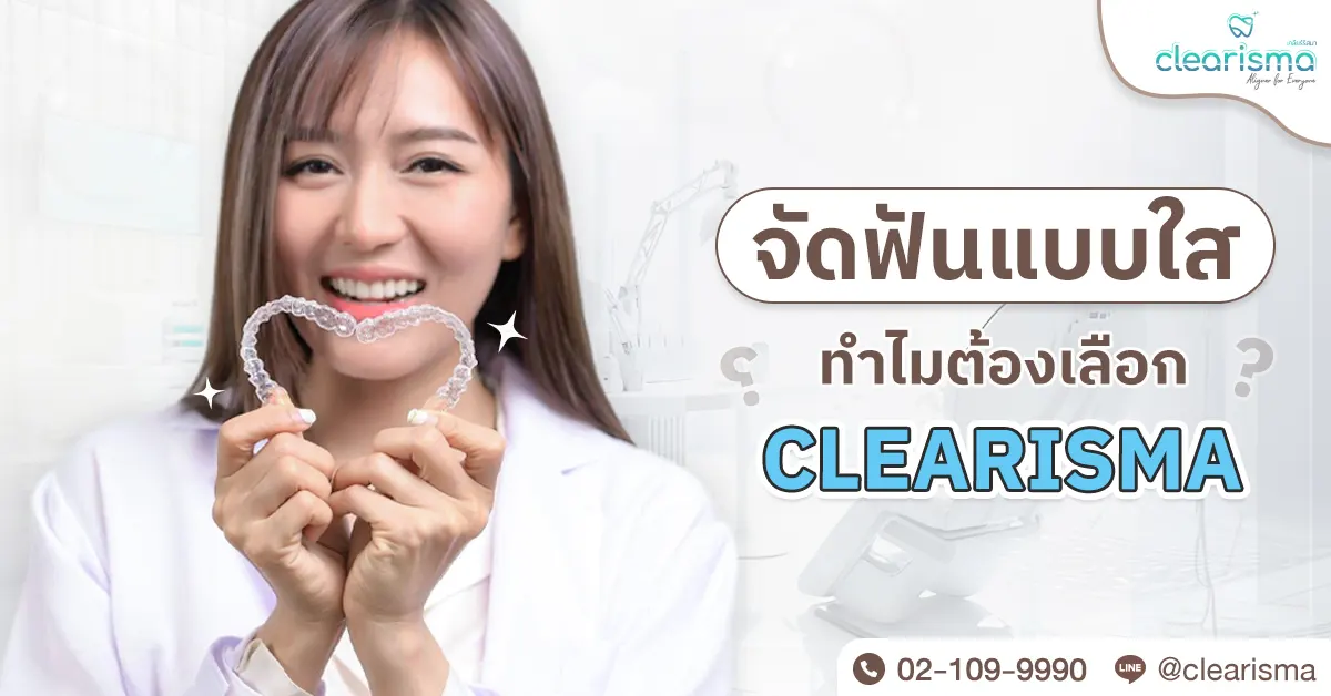 จัดฟันแบบใสทำไมต้องเลือก Clearisma