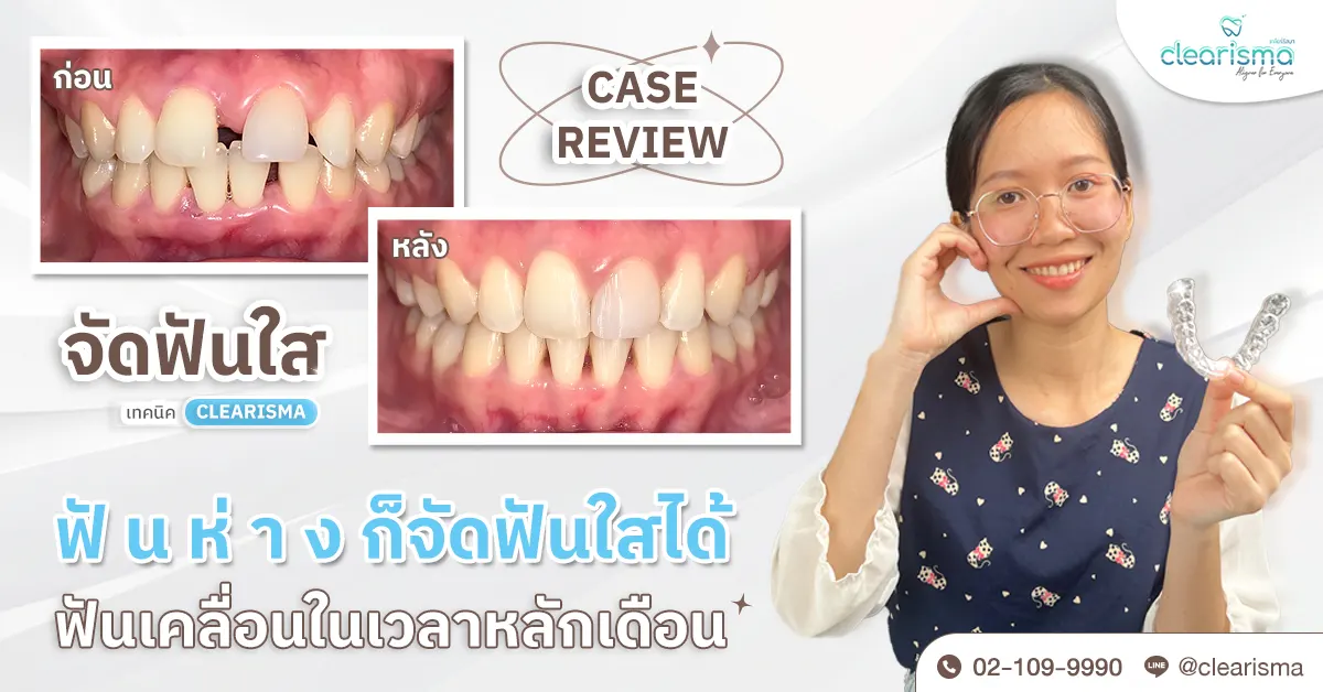 รีวิวคุณธิชาภรณ์ ห่อคำ