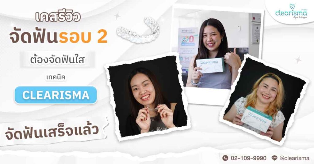 รวมรีวิวคนจัดฟันรอบ 2 ที่ Clearisma