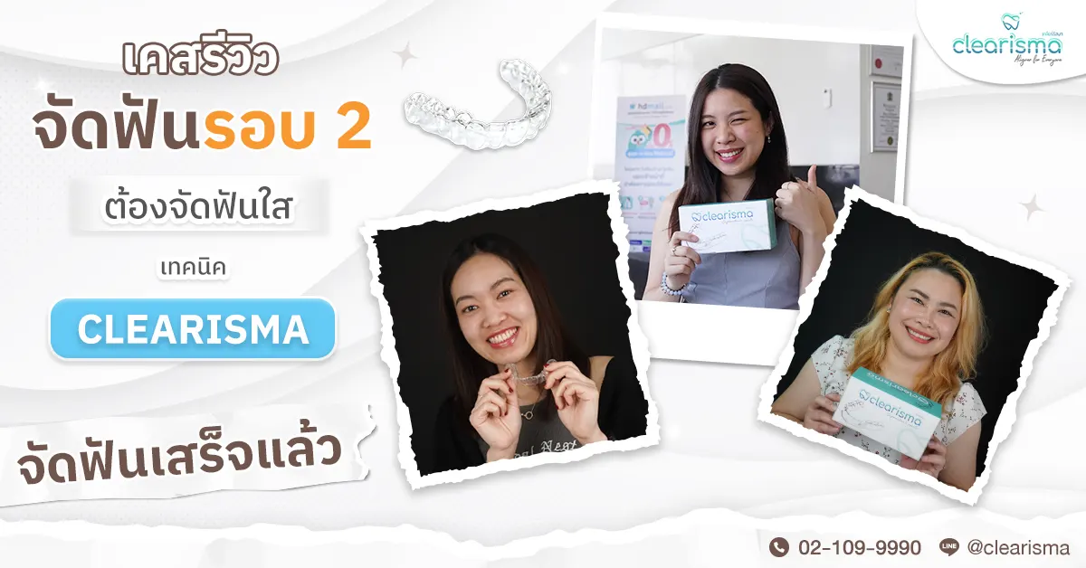 รวมรีวิวคนจัดฟันรอบ 2 ที่ Clearisma