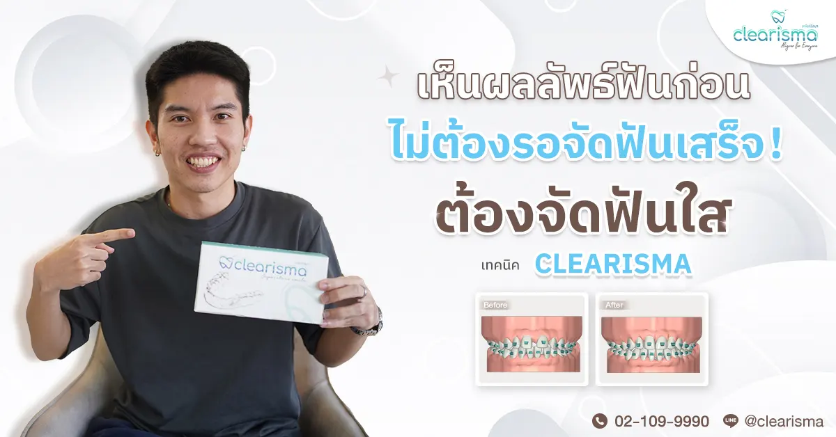 รีวิวคุณธาดา บัวทิม