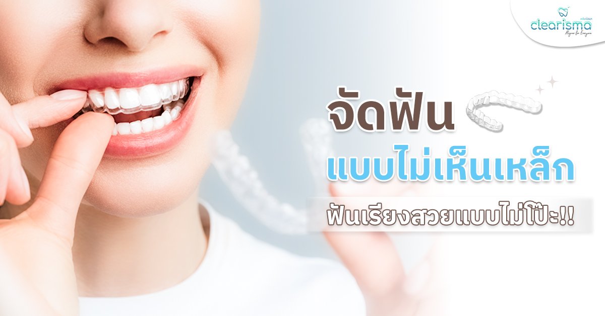 จัดฟันแบบไม่เห็นเหล็ก ฟันเรียงสวยแบบไม่โป๊ะ!!