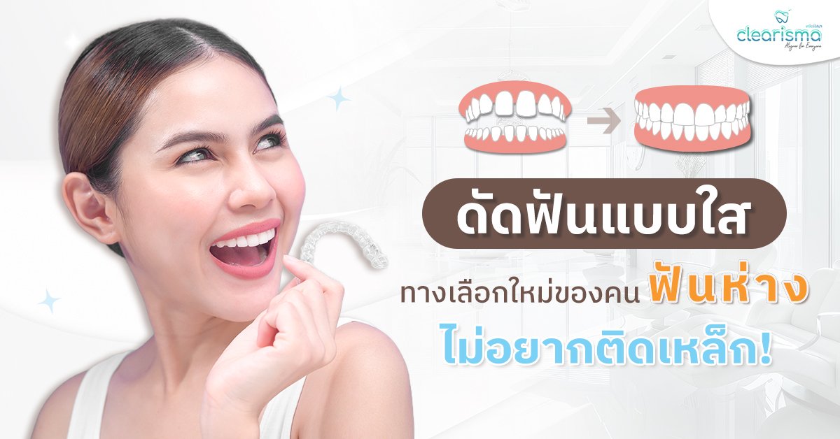 ดัดฟันแบบใส ทางเลือกใหม่ของคนฟันห่าง ไม่อยากติดเหล็ก