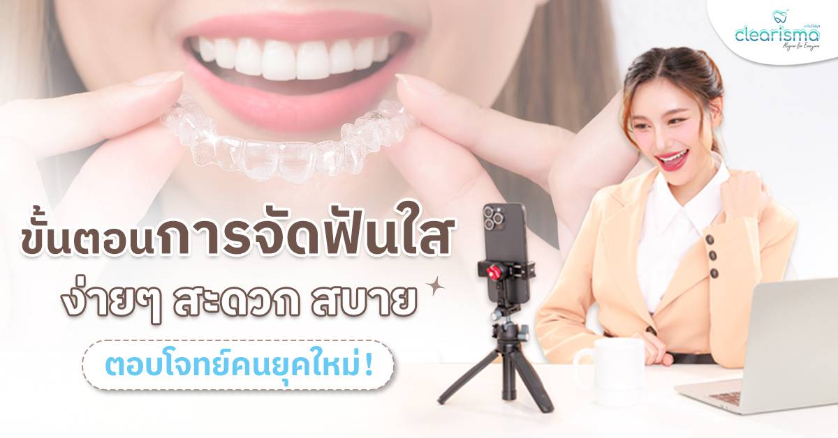 ขั้นตอนการจัดฟันใสง่ายๆ สะดวก สบาย ตอบโจทย์คนยุคใหม่!
