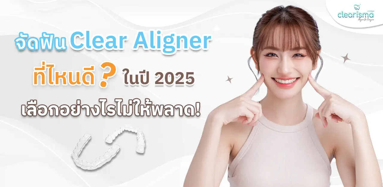 จัดฟัน Clear Aligner ที่ไหนดี