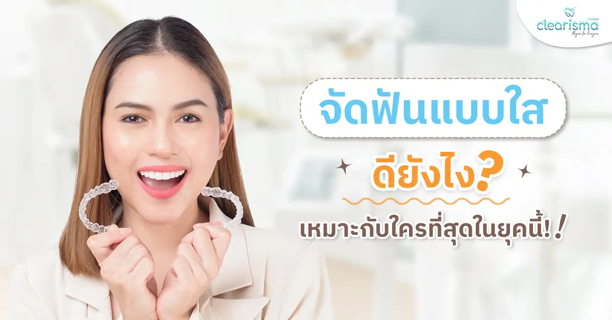 จัดฟันแบบใสดียังไง เหมาะกับใครที่สุดในยุคนี้!