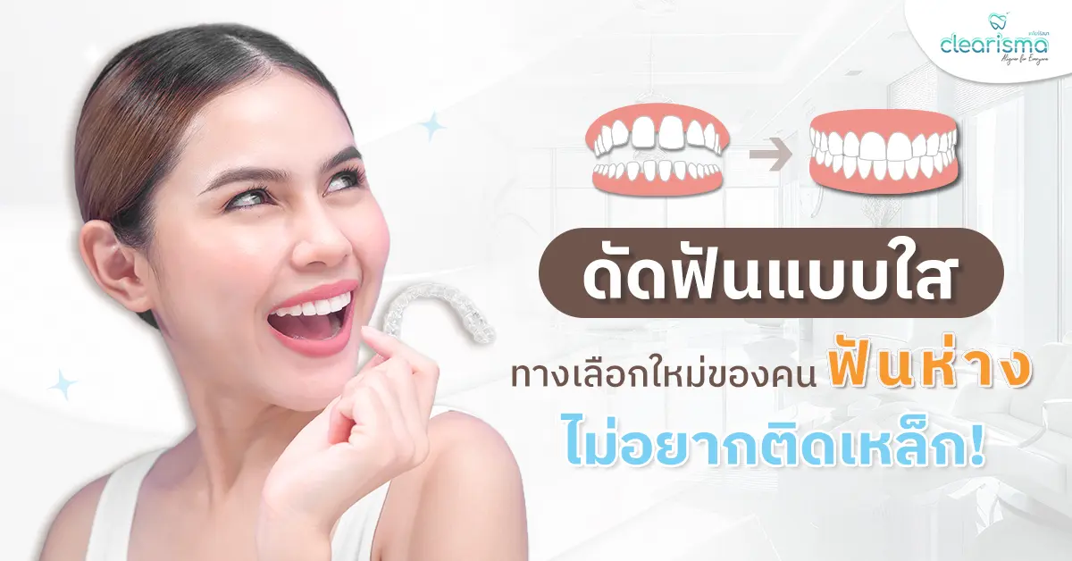ดัดฟันแบบใส ทางเลือกใหม่
