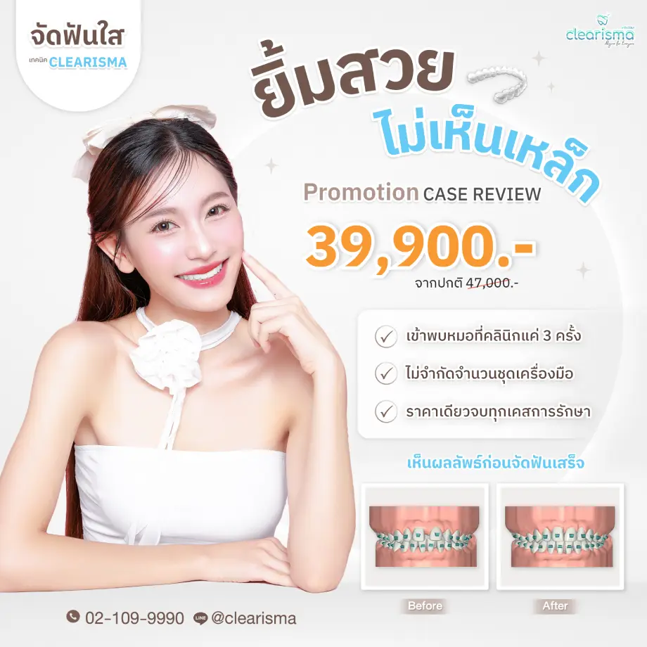 ยิ้มสวยไม่เห็นเหล็ก