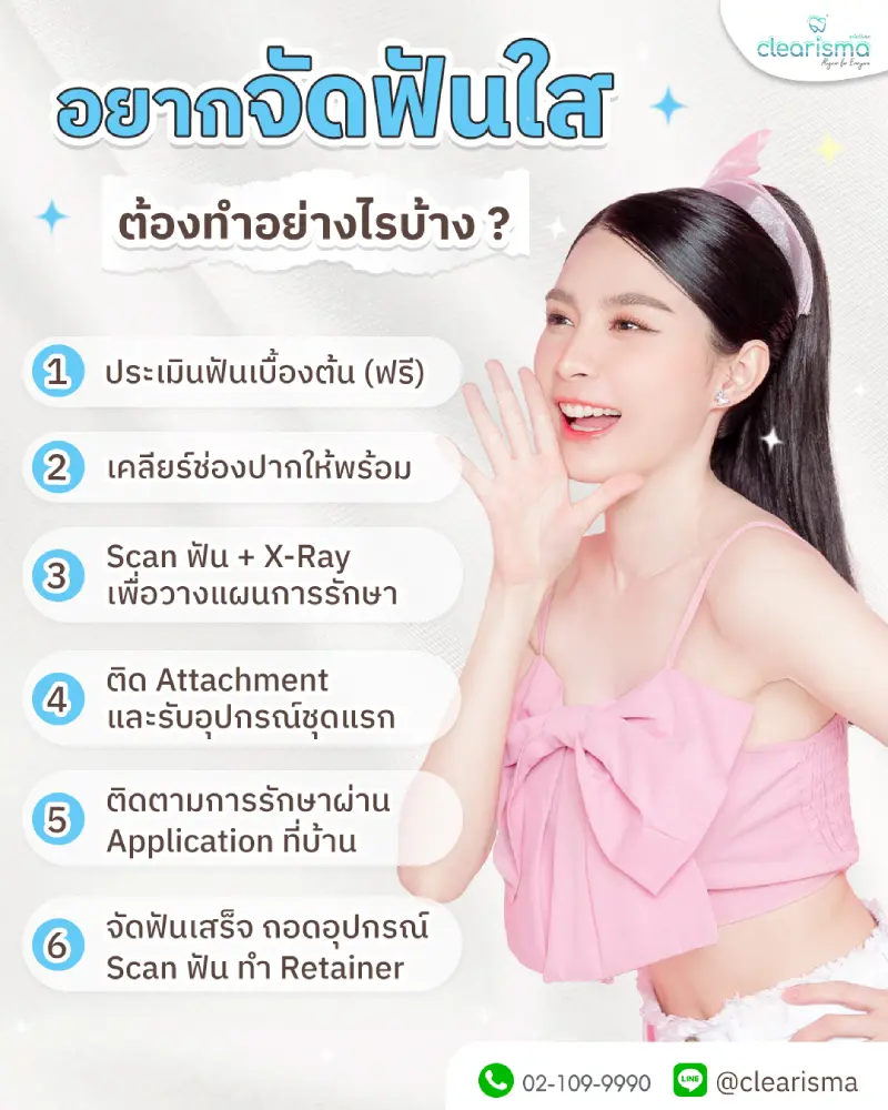 อยากจัดฟันใส ต้องทำอย่างไรบ้าง