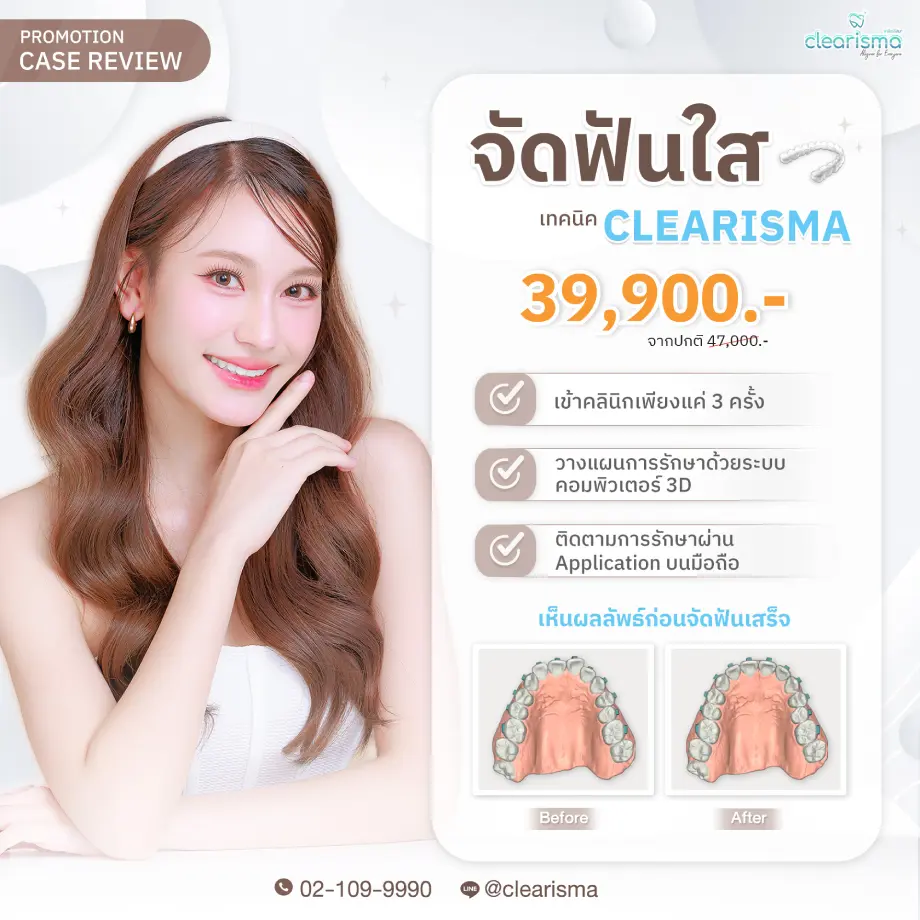 โปรโมชัน