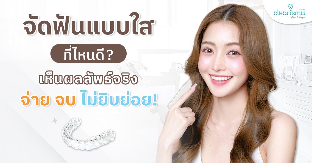 จัดฟันแบบใสที่ไหนดี เห็นผลลัพธ์จริง จ่าย จบ ไม่ยิบย่อย!