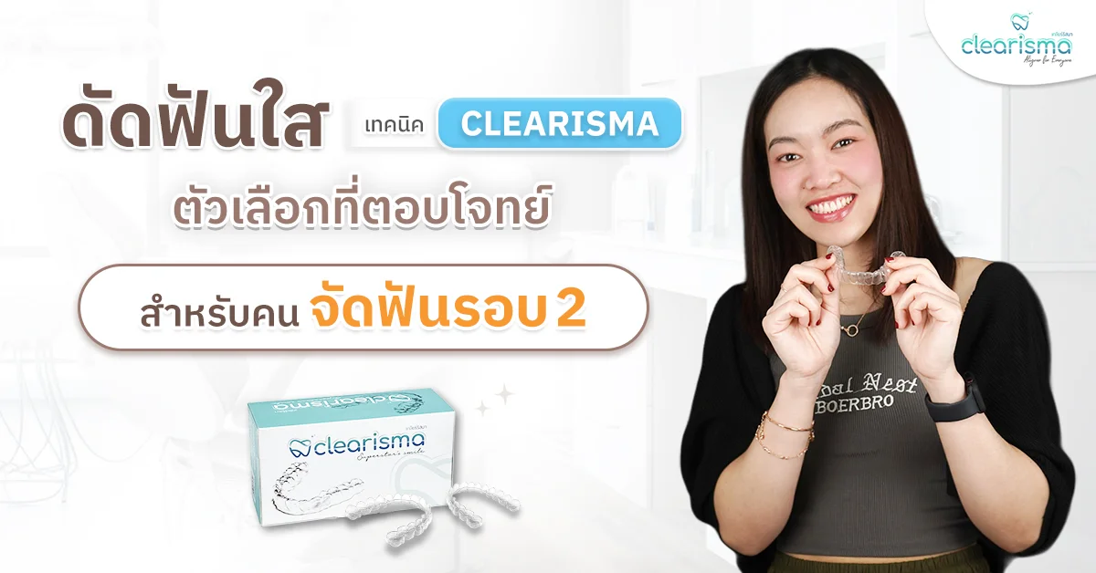 คนจัดฟันรอบ2