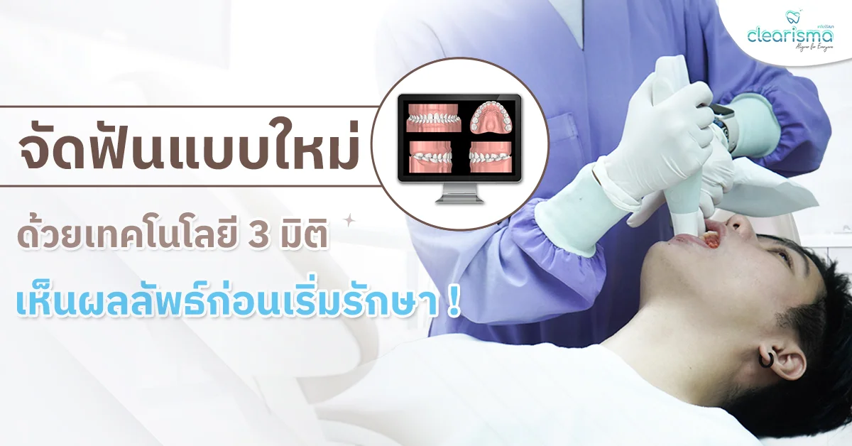 จัดฟันแบบใหม่ ด้วยเทคโนโลยี 3 มิติ