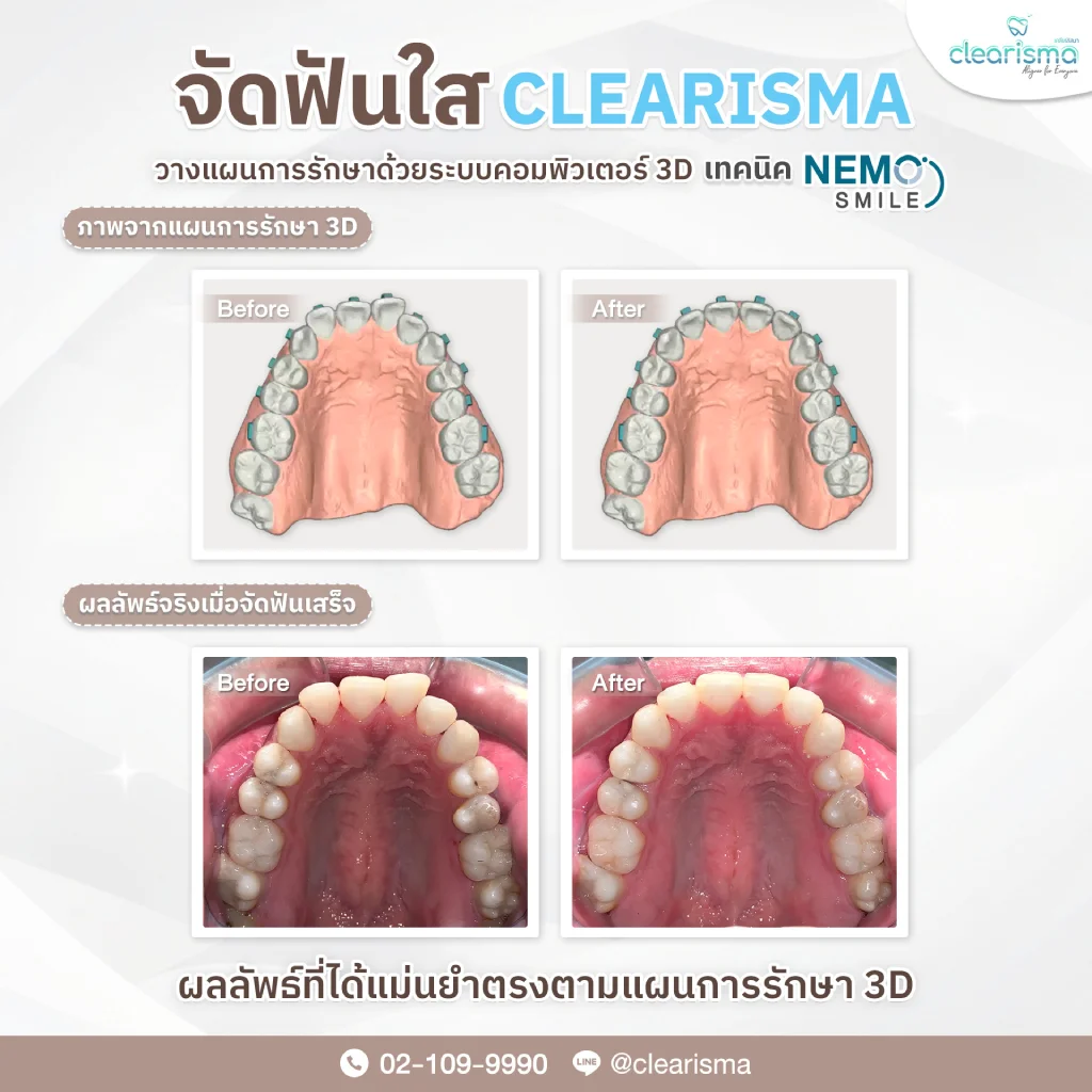 รีวิวผลลัพธ์แม่นยำ