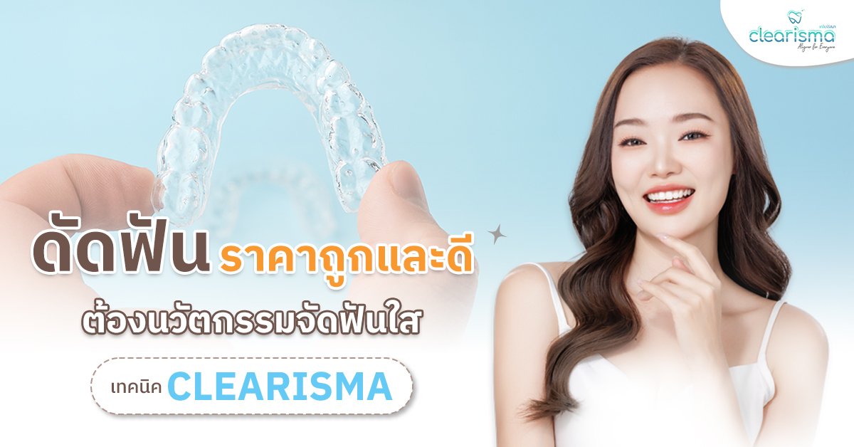 ดัดฟันราคาถูกและดี ต้องนวัตกรรมจัดฟันใสเทคนิค Clearisma