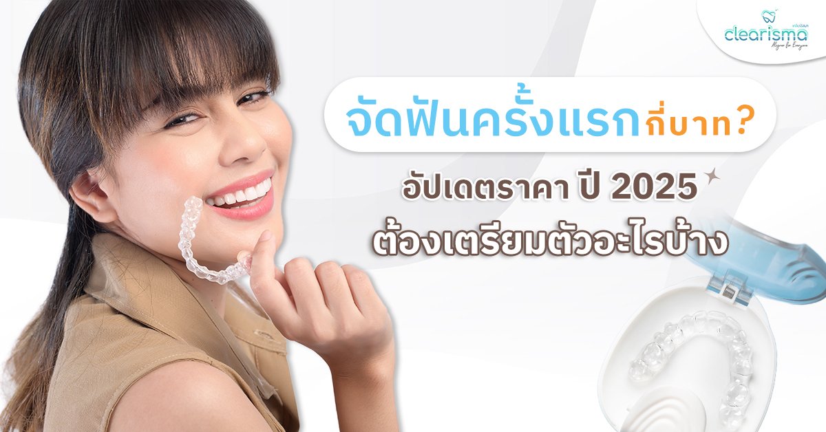 จัดฟันครั้งแรกกี่บาท อัปเดตราคา ปี 2568 ต้องเตรียมตัวอะไรบ้าง