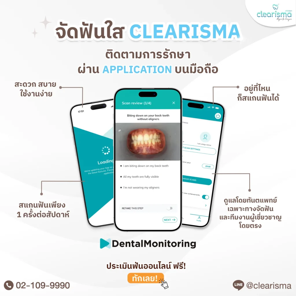 Clearisma ติดตามการรักษาบน application